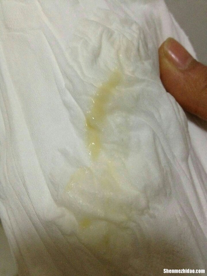 怀孕多久分泌物增多 怀孕多久分泌物增多会流产