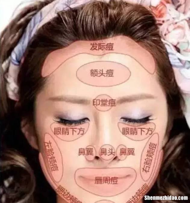 三十多岁的那女人长痤疮怎么办 三十多岁的那女人长痤疮怎么办呢