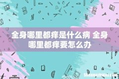 全身哪里都痒是什么病 全身哪里都痒要怎么办