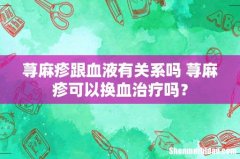 荨麻疹跟血液有关系吗 荨麻疹可以换血治疗吗？