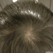 头发很粗怎么办 头发很粗怎么回事