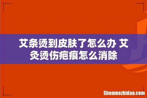 艾条烫到皮肤了怎么办 艾灸烫伤疤痕怎么消除