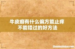 牛皮癣有什么偏方能止痒 不能错过的好方法