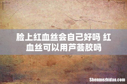 脸上红血丝会自己好吗 红血丝可以用芦荟胶吗