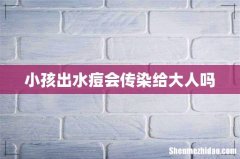 小孩出水痘会传染给大人吗