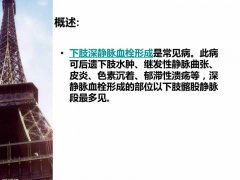 腿血栓怎么护理和治疗 腿血栓的最快消除方法是什么?