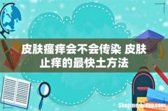 皮肤瘙痒会不会传染 皮肤止痒的最快土方法