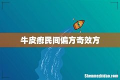 牛皮癣民间偏方奇效方