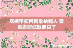 灰指甲如何传染给别人 看看这些你就明白了