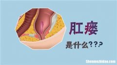 肛瘘怎么治 肛瘘怎么治能根除