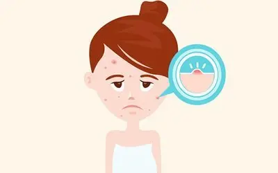 怎么样治疗青春痘 怎样才能治疗青春痘