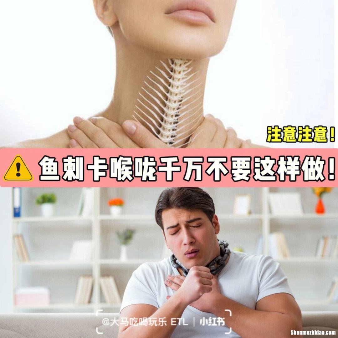 鱼刺卡到喉咙怎么办 4岁小孩鱼刺卡到喉咙怎么办