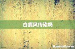 白癜风传染吗