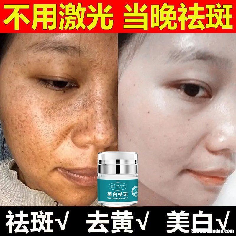 怎么去黑斑 雀斑去除的最佳方法